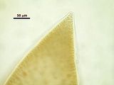2 – Dettaglio di un apice con cellula apicale che si divide tramite un setto obliquo